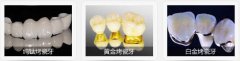 如何选择牙齿修复材料